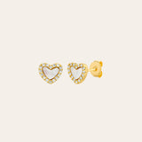 ARETE CORAZON NACAR